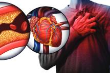 Cardiovascular disease: Approved Doctors will be on the lookout for warning signs that a person may be at risk of suffering a sudden and disabling event. ENG1 restrictions may be issued. Image: Getty Images Image:Cardiovascular disease: Approved Doctors will be on the lookout for warning signs that a person may be at risk of suffering a sudden and disabling event. ENG1 restrictions may be issued. Image: Getty Images