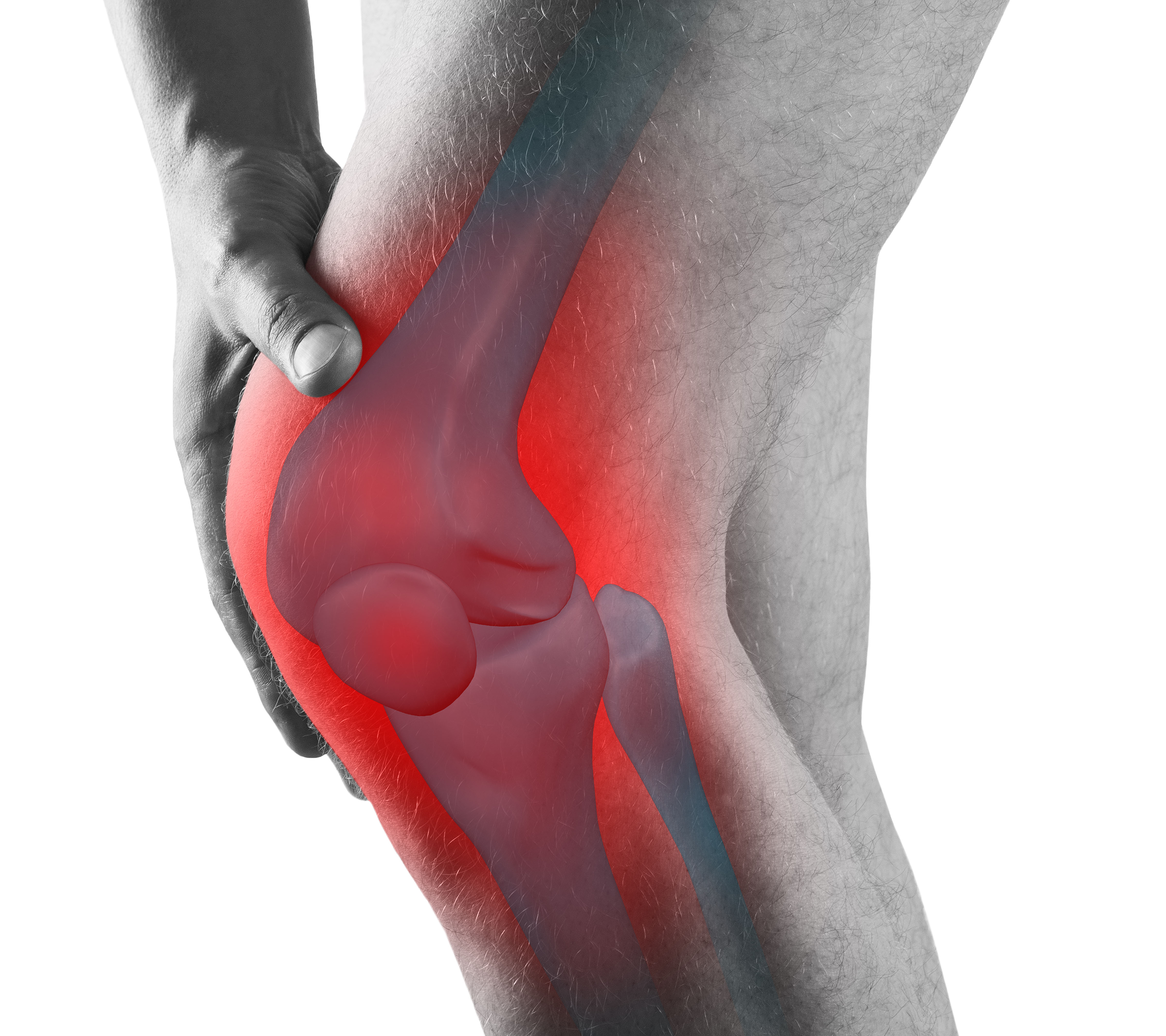 mca_feature_rheumatoid_arthritis_web_insert.jpg mca_feature_rheumatoid_arthritis_web_insert.jpg